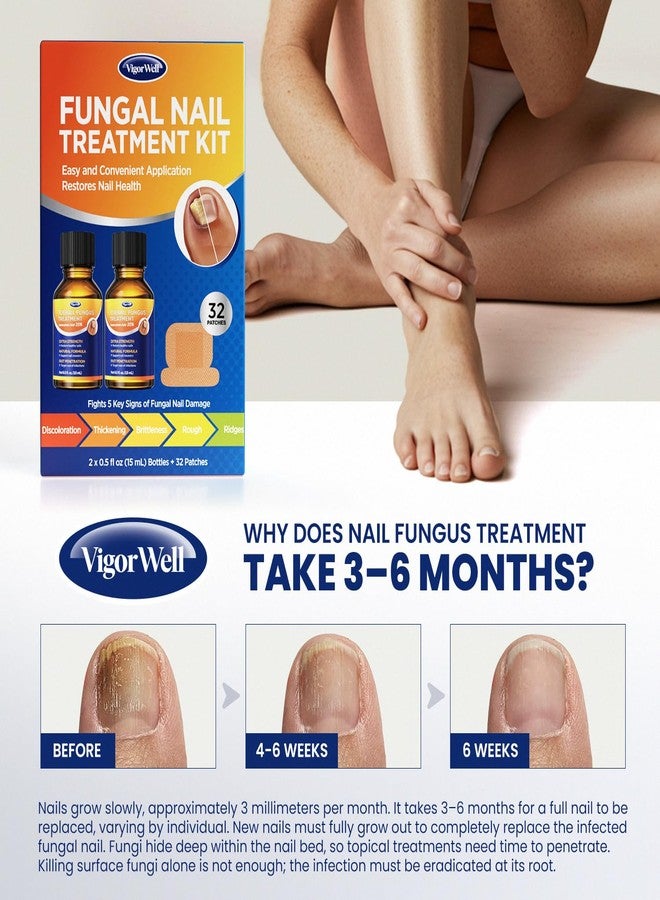 VigorWell Toenail Treatment Extra Strength: Dual Action Nail Repair Kit for Thick, Brittle or Discolored Nails - 30 ml Nail Repair Gel with 25% Undecylenic Acid - (Medium) 32 Nail Patches - Image 4